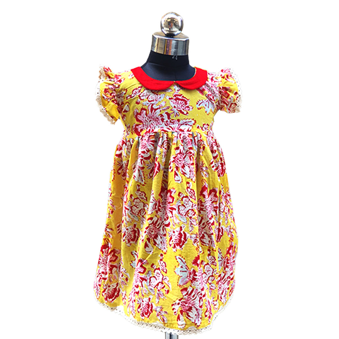 yellow frock