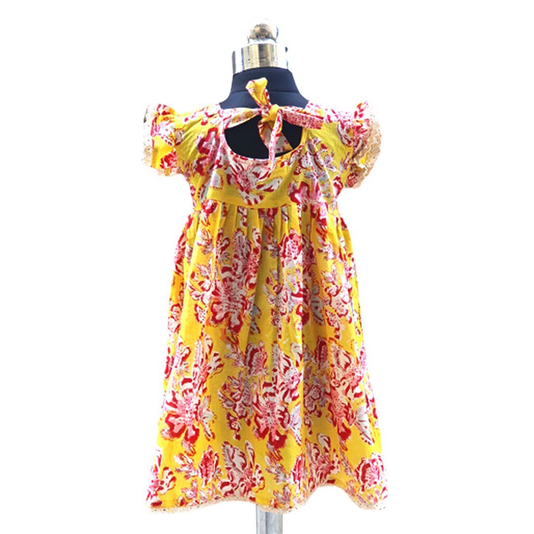 yellow frock back